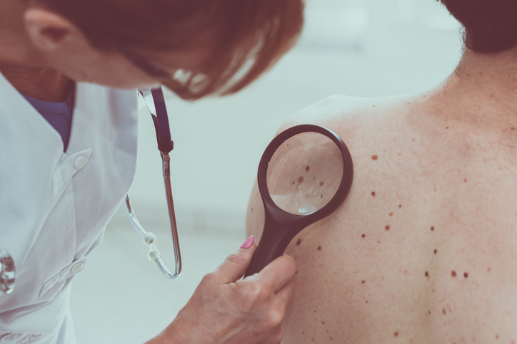 skin cancer screening ogden ut